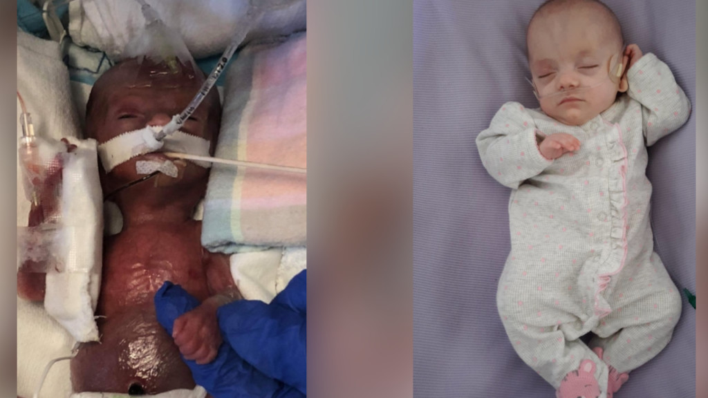 Miracle Monday: Spokane baby born weighing less than a pound defies all odds