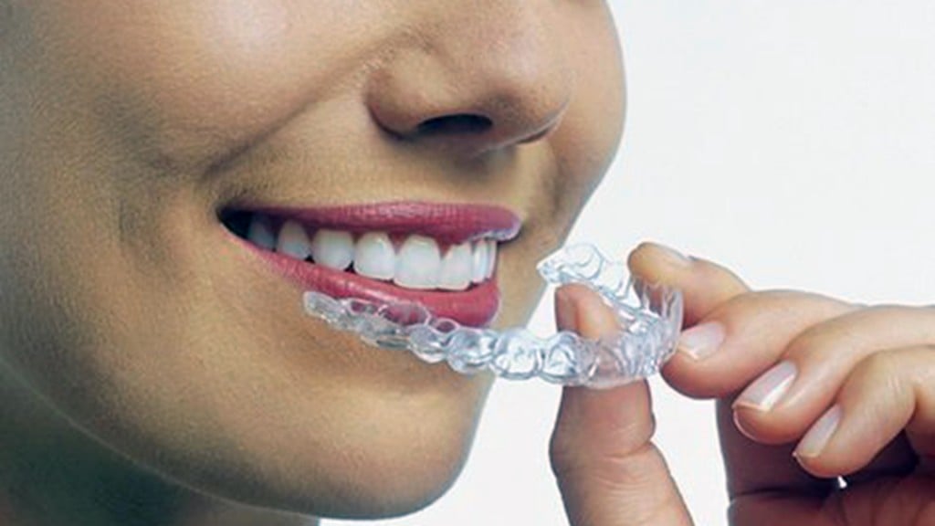 The hottest stock of the year: Invisalign