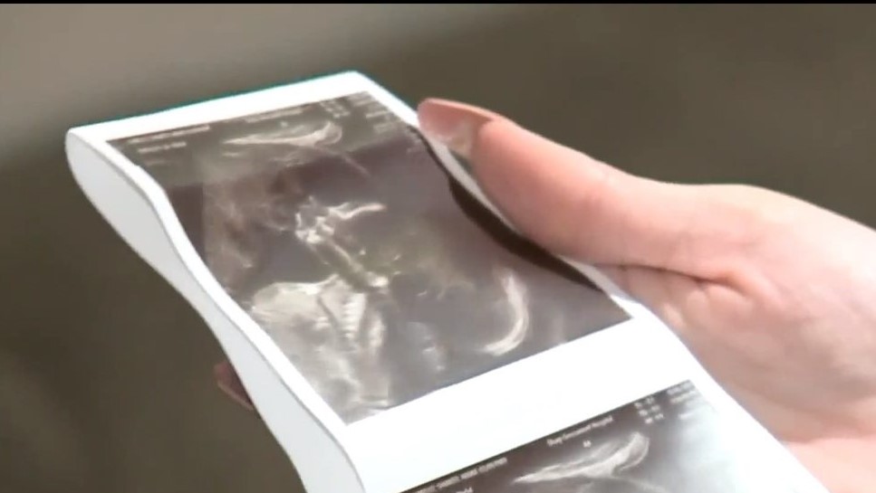 San Diego woman sees late father in ultrasound photo