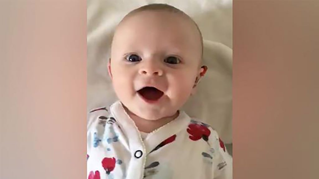 Video captures sound of joy when baby’s hearing aid is turned on