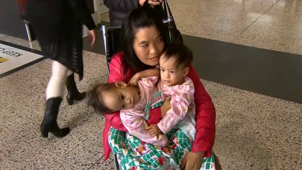 Conjoined twins flown from Bhutan to Australia for operation