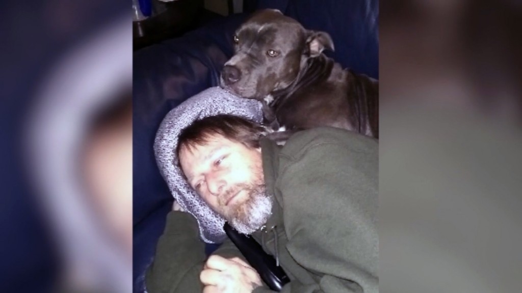 Man’s limbs amputated after being licked by dog