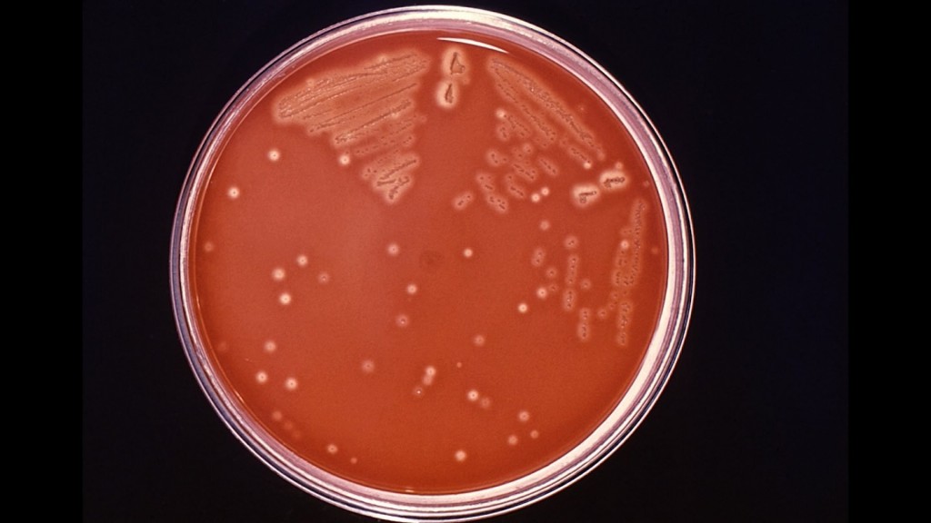 Flesh-eating bacteria kills a Memphis man who visited Florida waterways
