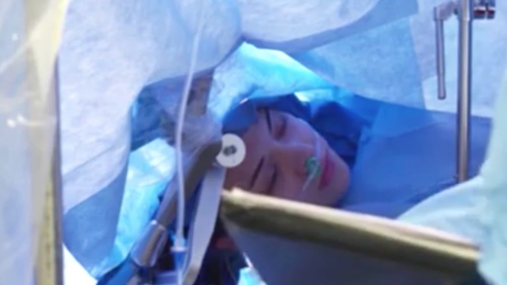 Woman awake during livestreamed brain surgery