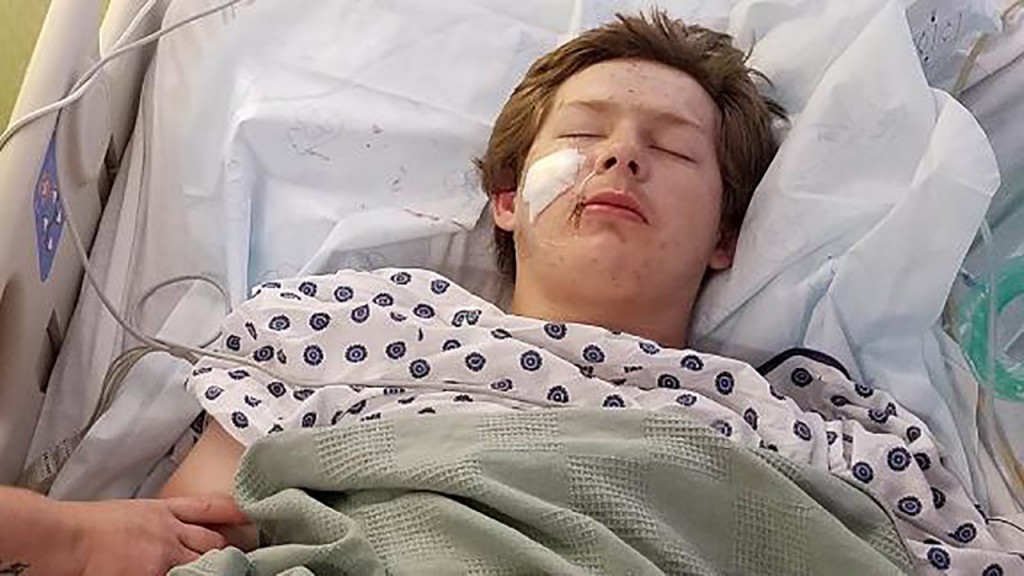 Teen survives 10-inch knife lodged in face
