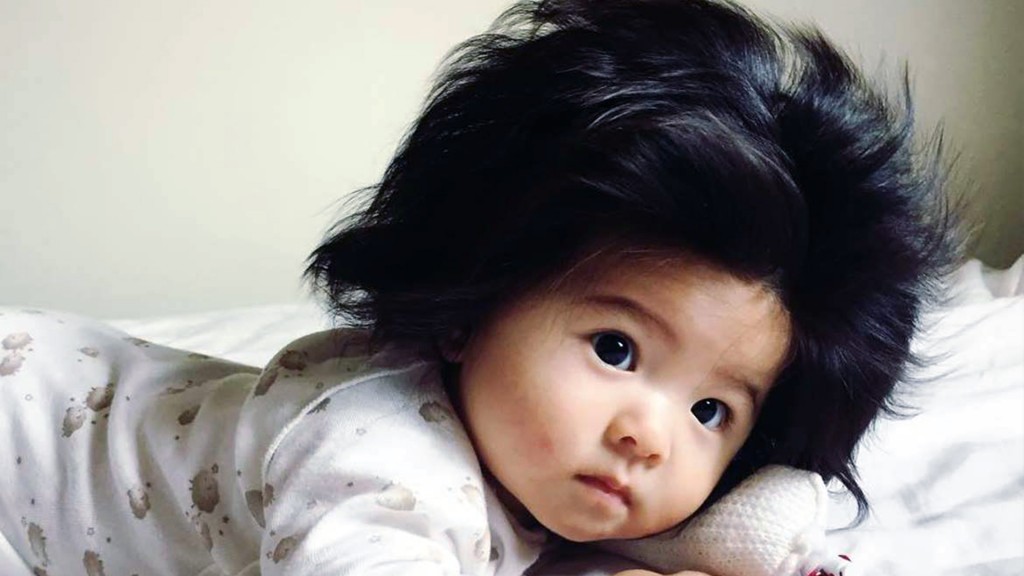 Baby Chanco’s full head of hair goes viral