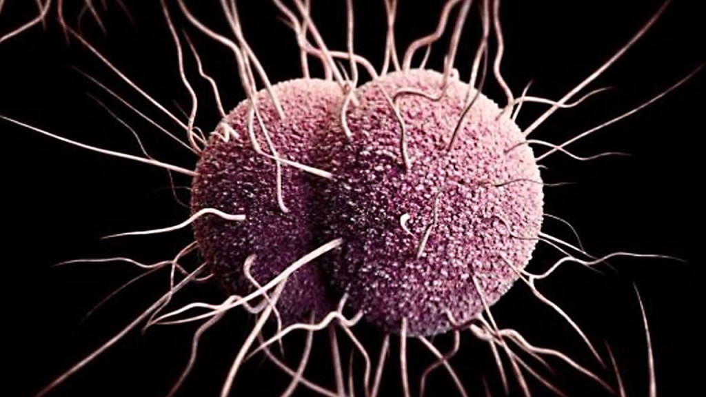 First case of super-resistant gonorrhea reported
