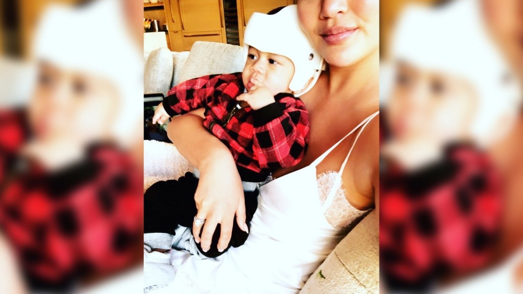 Chrissy Teigen shares pic of son with head-shaping helmet