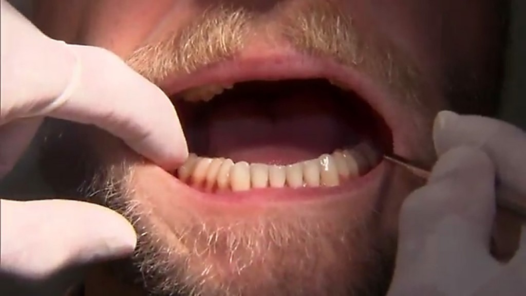 States with best, worst dental health