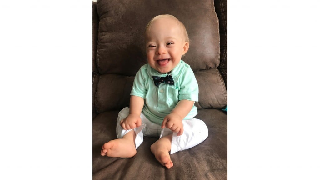 For the first time in its history, the Gerber spokesbaby is a child with Down syndrome
