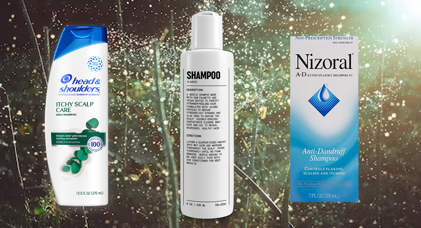 The Best Shampoos for Itchy Scalps Orlando Magazine