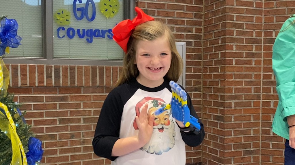 High School Students Construct Gift Of A Lifetime For 8 Year Old Without A Left Hand