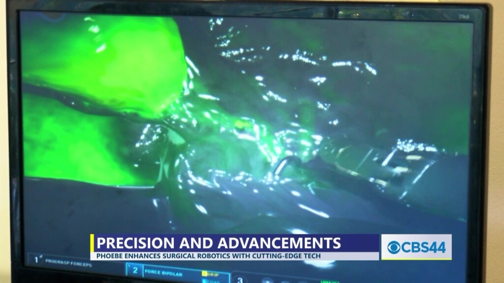 Phoebe Expands Its Surgical Robotics Program
