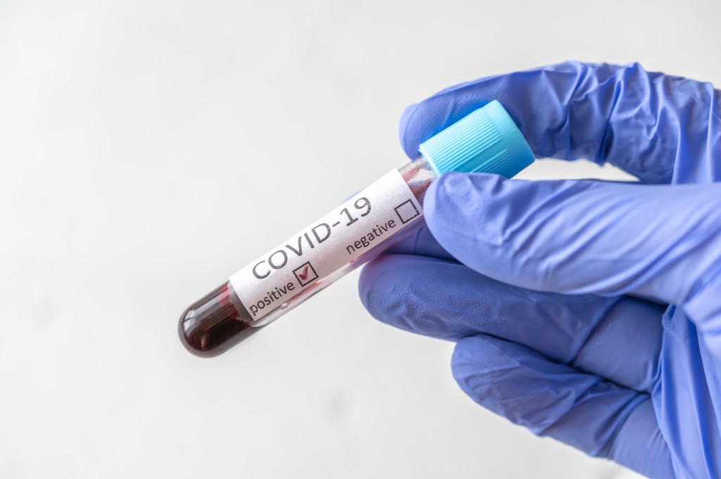 Coronavirus Testing