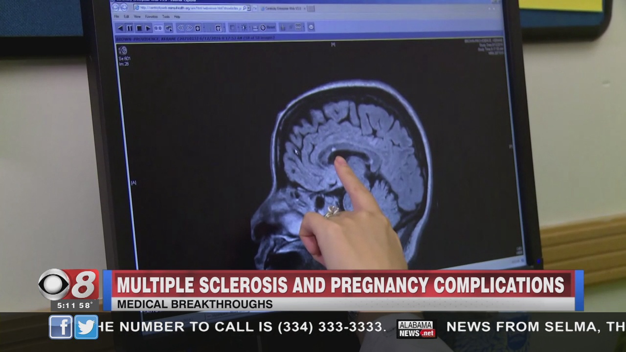 Medical Breakthroughs Parkinson's Monitoring System+Multiple Sclerosis
