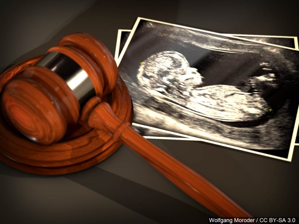 Mgn 1280x960 90205b00 Pgycl