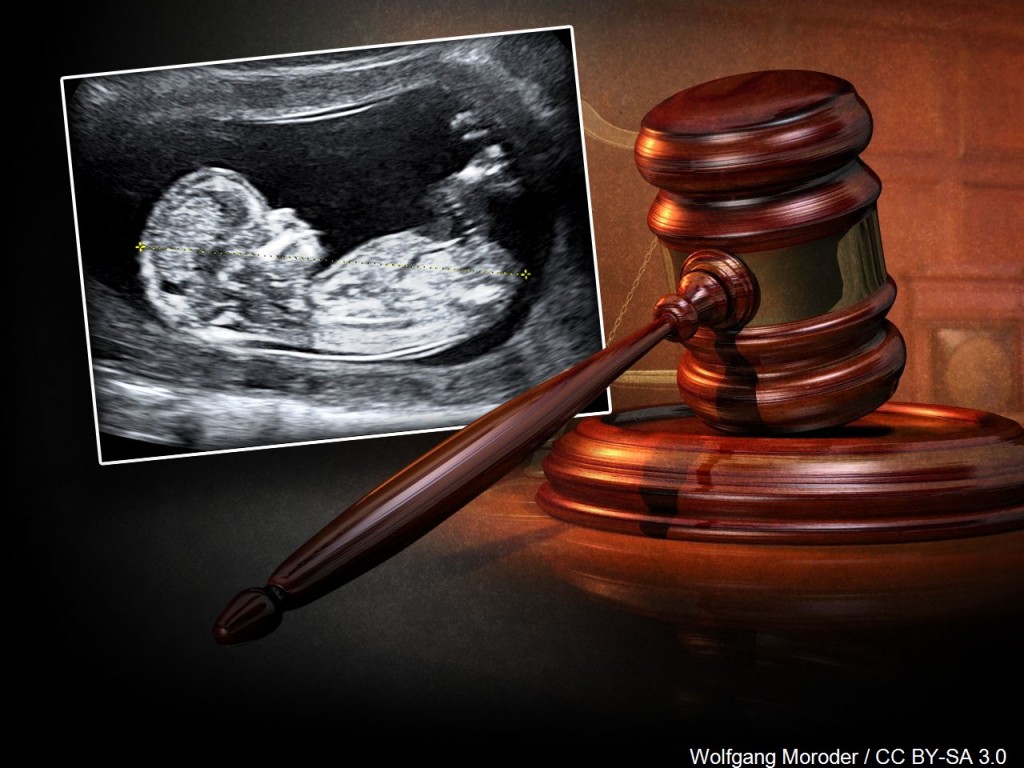 Mgn 1280x960 60520b00 Yomsx