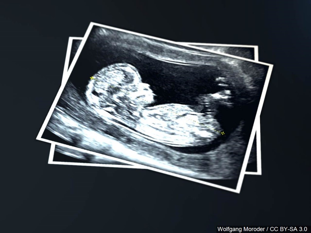 Mgn 1280x960 91002b00 Hfrkb