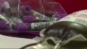 Blood Supply Presser Pkg 011022