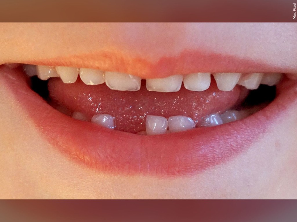 dental