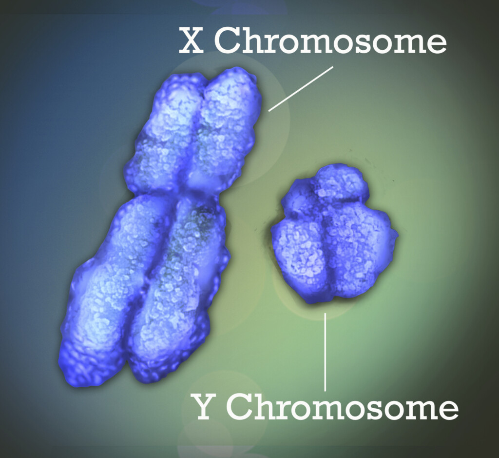Autoimmune Diseases Women