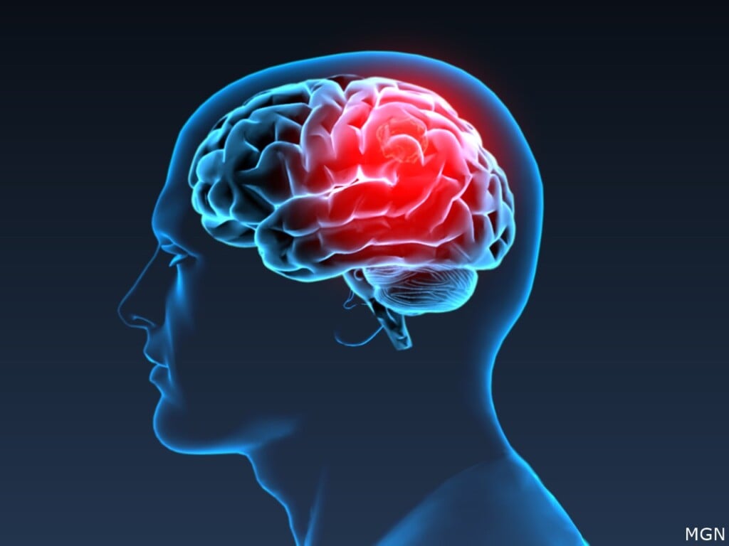 brain cancer
