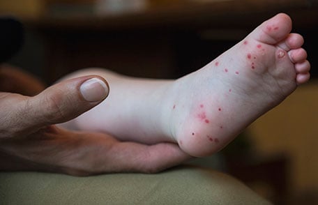 disease
