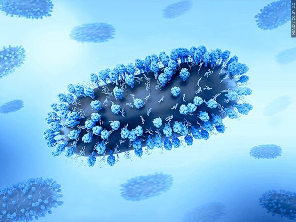 Mgn 1280x960 31228p00 Ronir