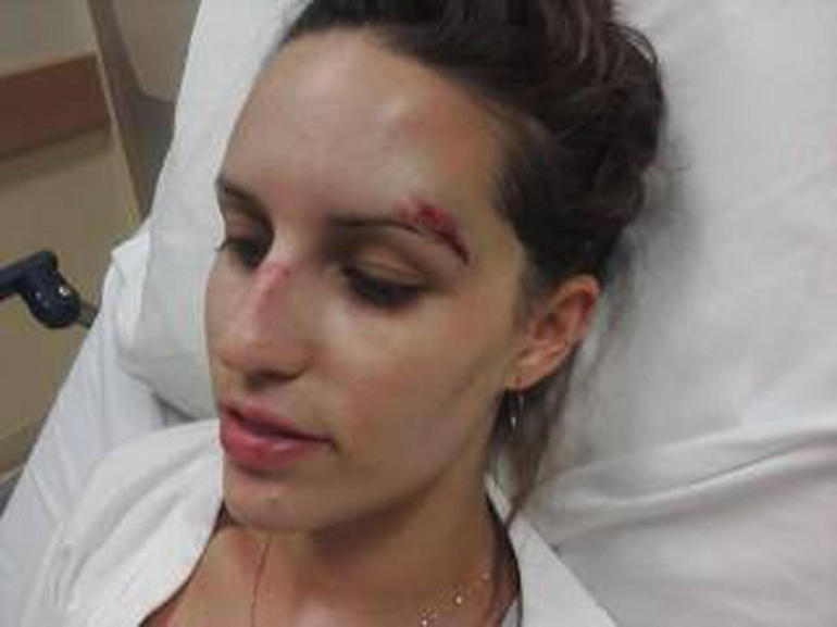ncis-briana-injury.jpg 