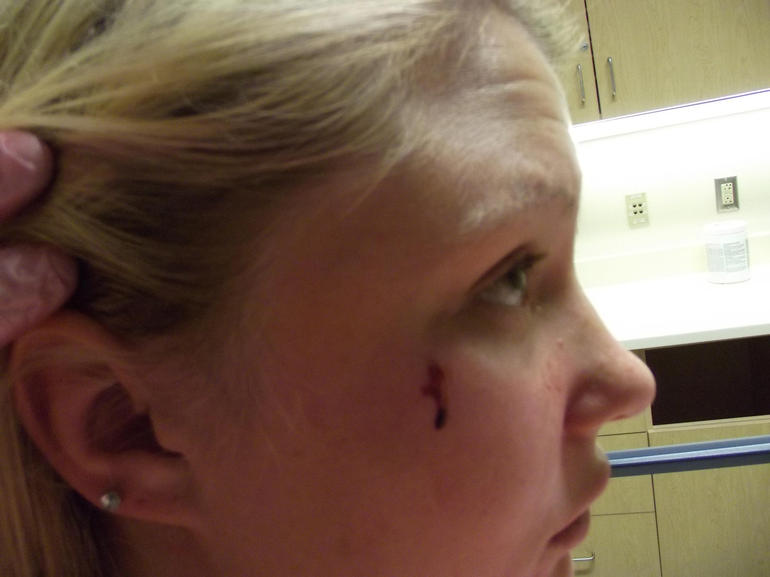 ncis-sarah-injury.jpg 