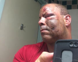 post-accident-selfie-web.jpg 