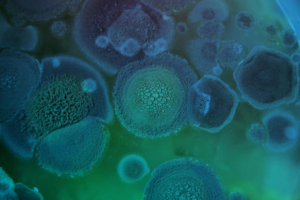 Aspergillus fumigatus 