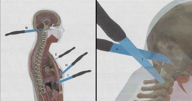 Ellen Greenberg wounds graphic 