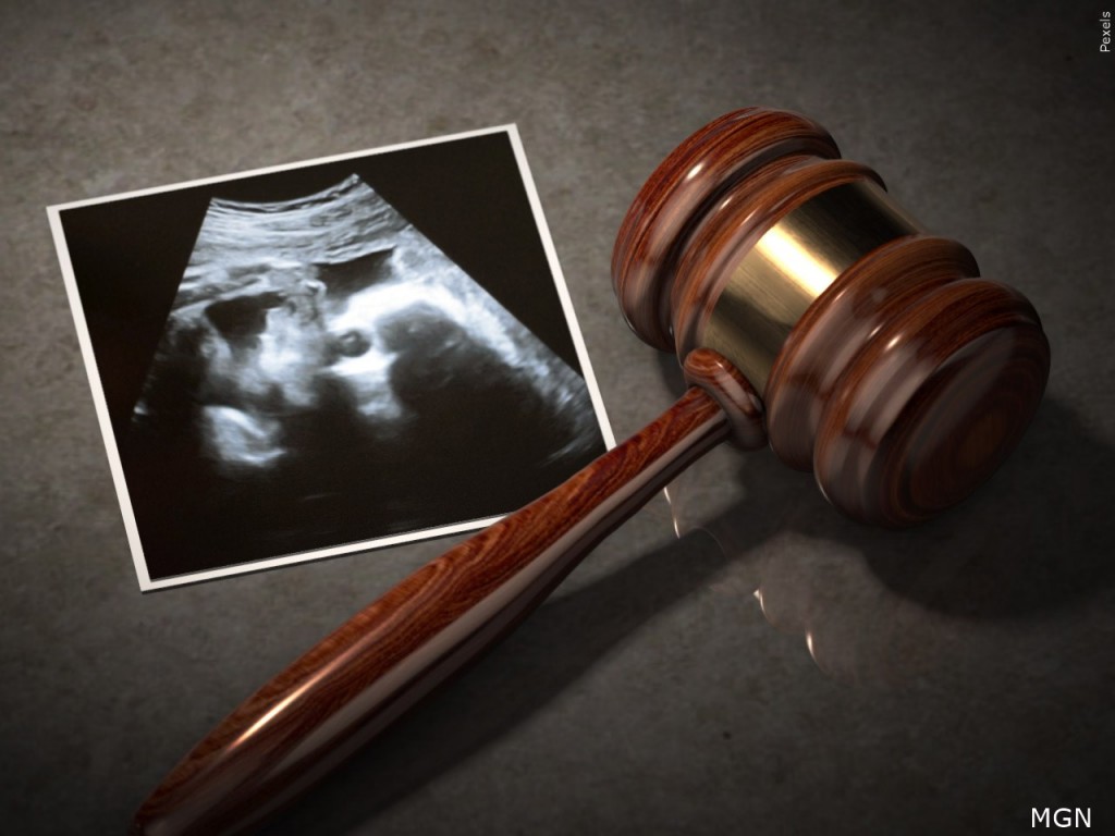 Abortion Case