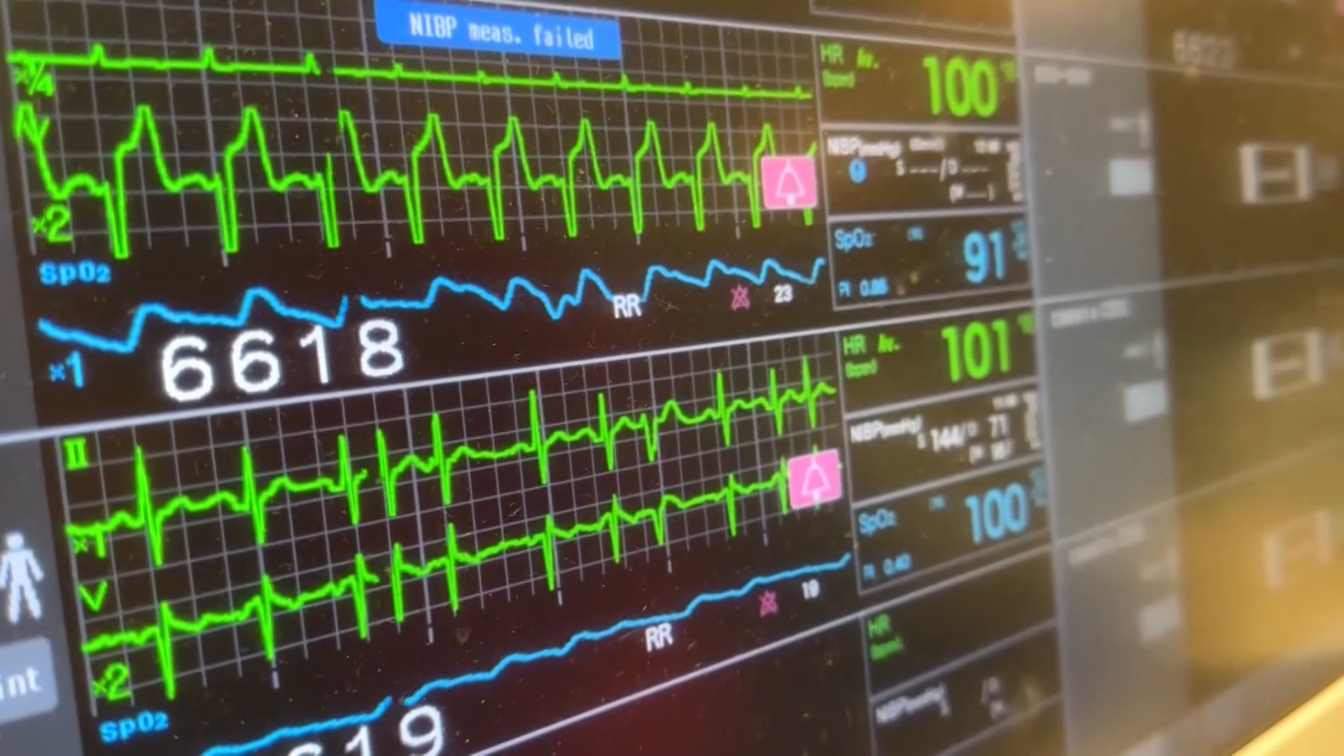 Medicaid Reimbursement Plan: How area hospitals can be impacted - Vimarsana News