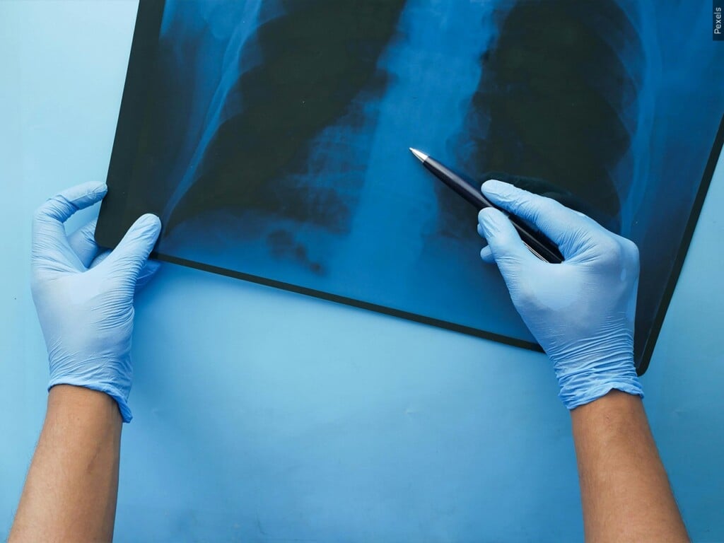 respiratory illness