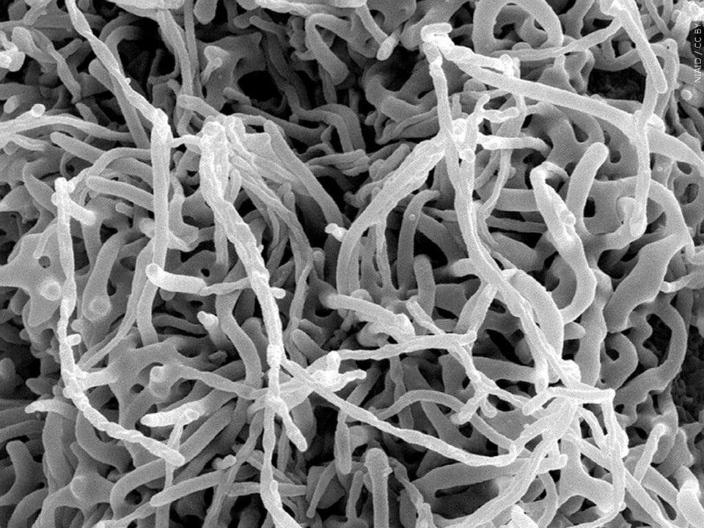 Ebola