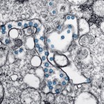 2020 Electron Microscope Image Made Available By The U.s. Centers For Disease Control And Prevention Shows The Spherical Particles Of The New Coronavirus