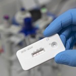 Scientist Presents An Antibody Test For Coronavirus In A Laboratory Of The Leibniz Institute Of Photonic Technology