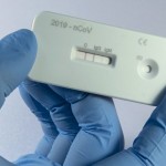 Scientist Presents An Antibody Test For Coronavirus In A Laboratory Of The Leibniz Institute Of Photonic Technology (leibniz Ipht) At The Infectognostics Research Campus In Jena, Germany