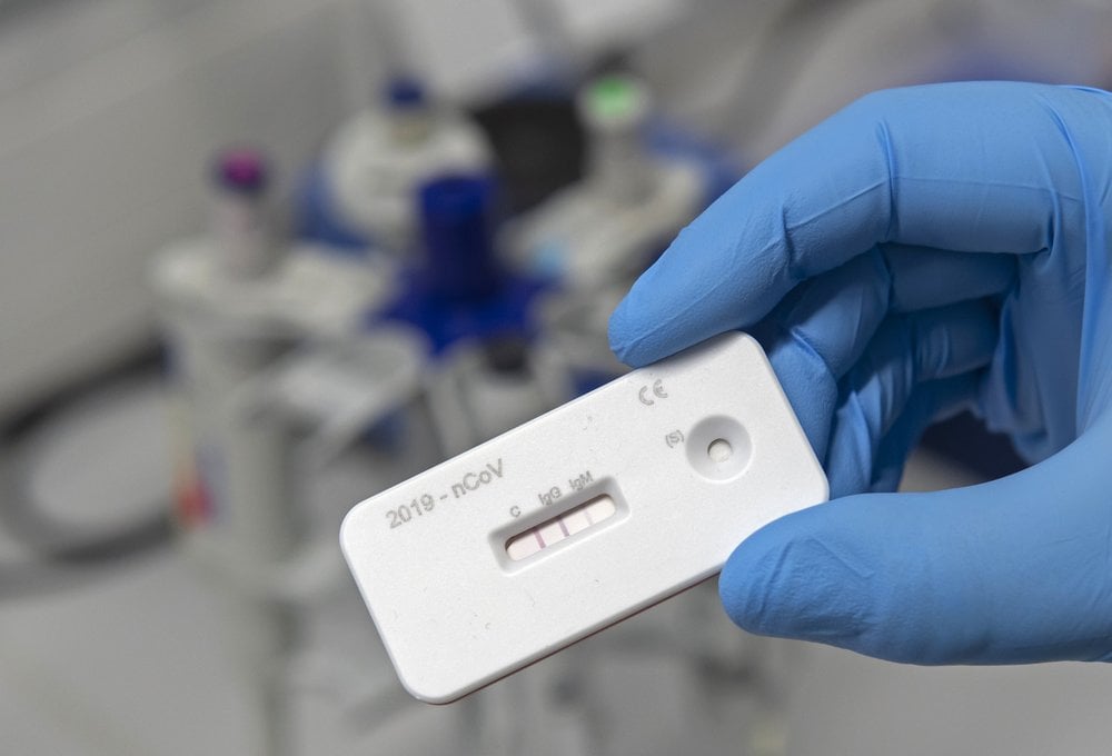 Scientist Presents An Antibody Test For Coronavirus In A Laboratory Of The Leibniz Institute Of Photonic Technology
