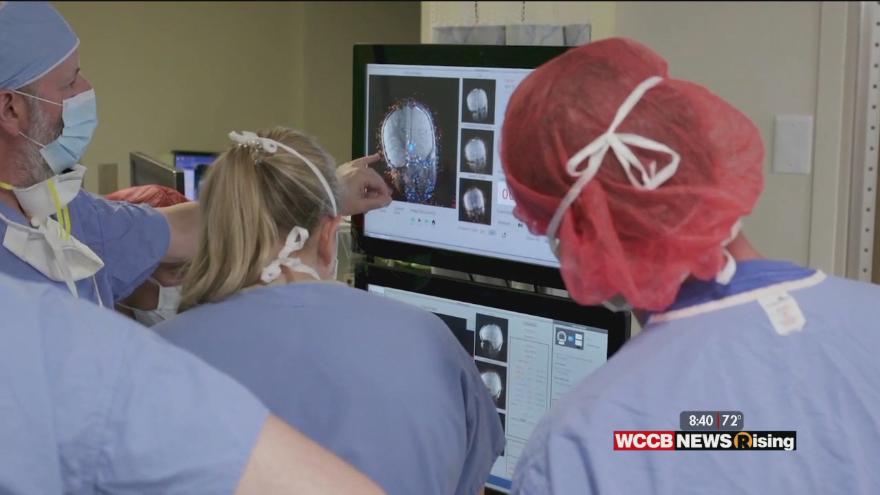 Healthy Headlines MinimallyInvasive Brain Surgery WCCB