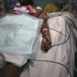 A Patient Affected With Covid 19 Lies On A Bed In A Marseille Hospital, Southern France