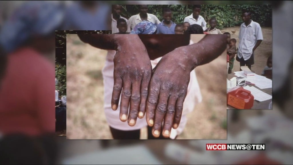 Health Officials Keeping A Close Eye On Spread Of Monkeypox Virus