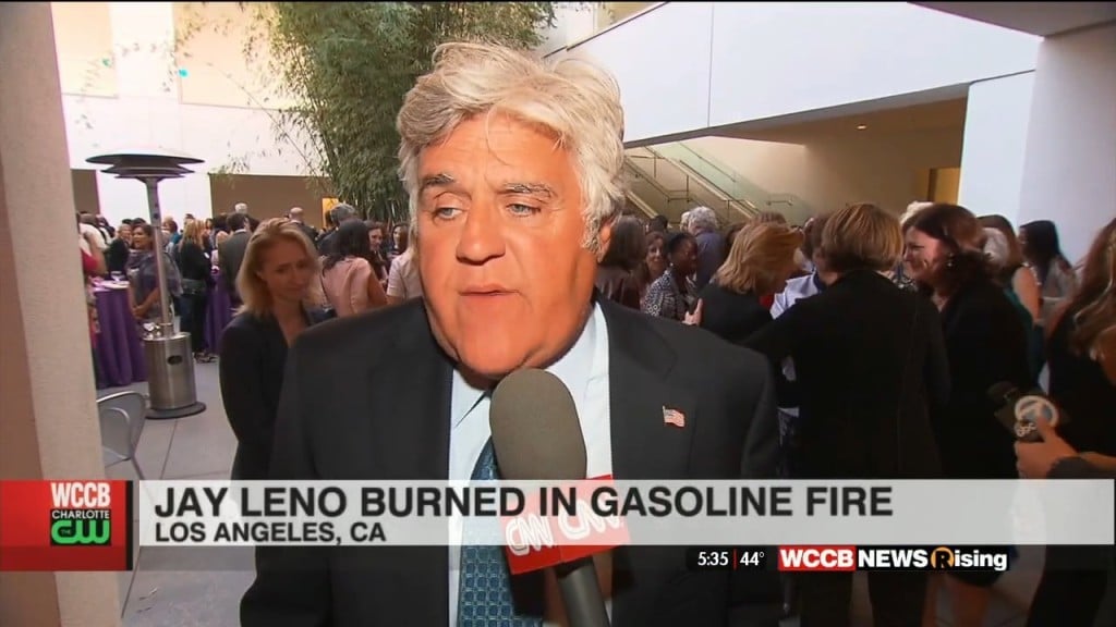 Jay Leno Burned In Car Fire