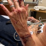 Bear Attack Hand