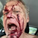 Bear attack