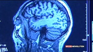 Support Grows For Psychedelic "breakthrough Therapies"