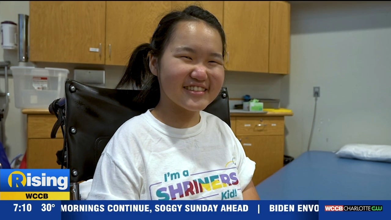 Shriners Children's Hospital Helps Arthrogryposis Patients With Top Of