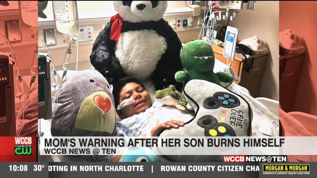 10 Year Old Boy Suffers Second Degree Burns After Playing With Lighter